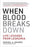 When Blood Breaks Down: Life Lessons from Leukemia (Mit Press)